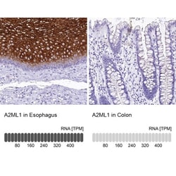 alpha 2-Macroglobulin-like 1/A2ML1 Antibody, Novus Biologicals:Antibodies:Primary